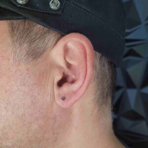 Perforación del lóbulo de la oreja con pendiente cónico negro en la oreja izquierda en Lethal Ink Tattoo Pattaya. Piercing de un solo anillo en el lóbulo de la oreja con pendiente cónico negro de acero quirúrgico en la oreja izquierda en Lethal Ink Tattoo Pattaya (2026)
